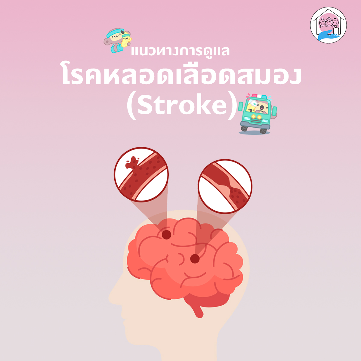 Stroke